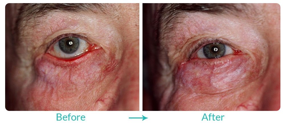 Case 226