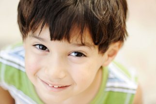 Pediatric Oculoplastic Surgery Los Angeles