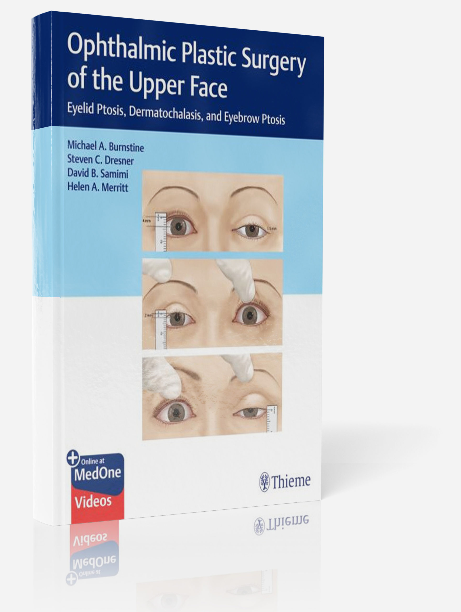Ophthalmic Plastic Surgery of the Upper Face Book