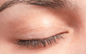 Ectropion vs. Entropion: What's the Difference? Closed eyes