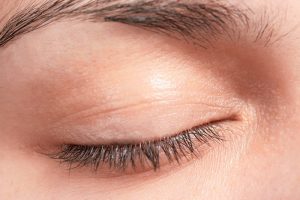 Eyelid Spasms: Understanding Their Causes and Treatments Eyelid spasms