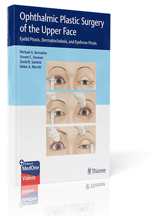 Ophthalmic Plastic Surgery of the Upper Face