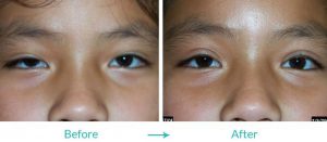 eyesthetica certified pediatric doctors