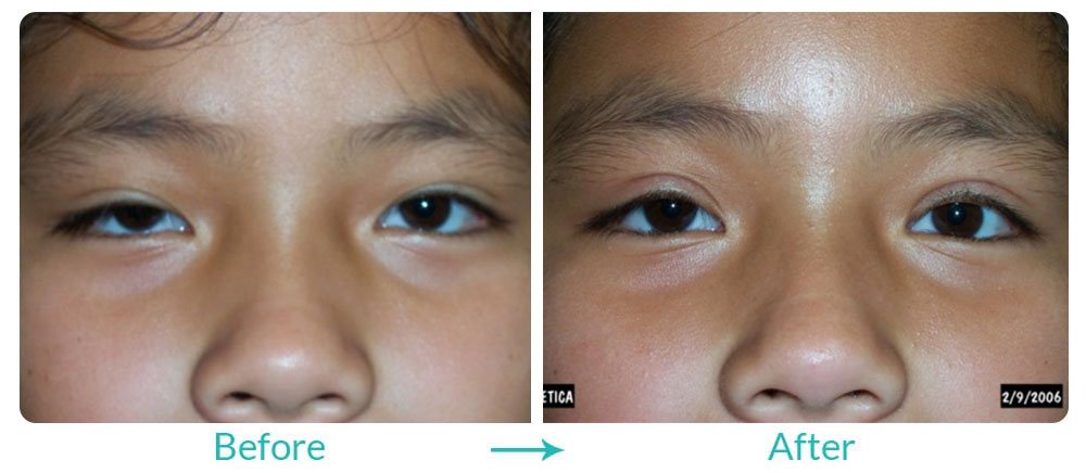 eyesthetica certified pediatric doctors